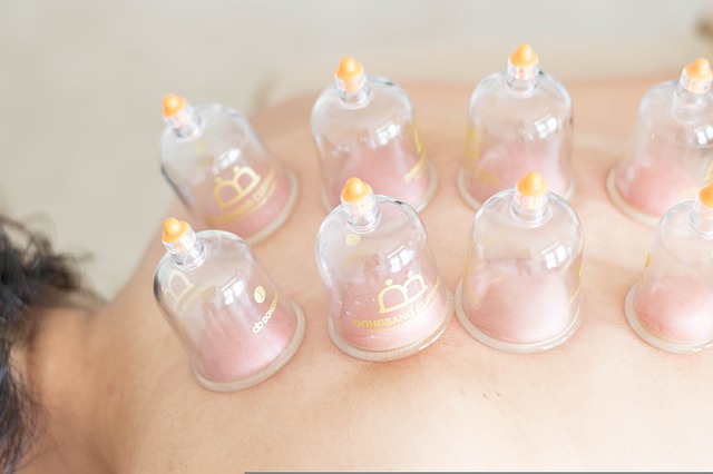 Cupping Treatment